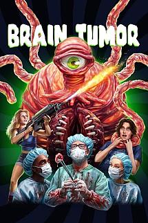 Brain Tumor izle