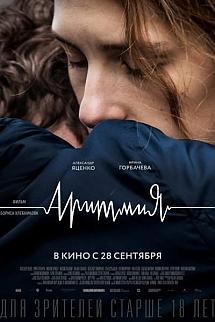 Aritmiya izle