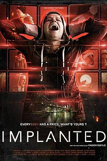 İmplant izle