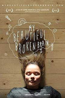 My Beautiful Broken Brain izle