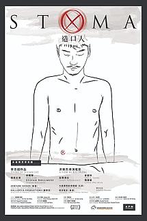 Stoma izle