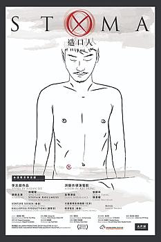 Stoma
